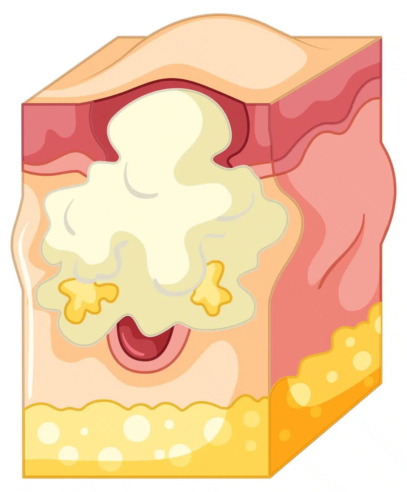 Sources of adipose-derived Exosomes